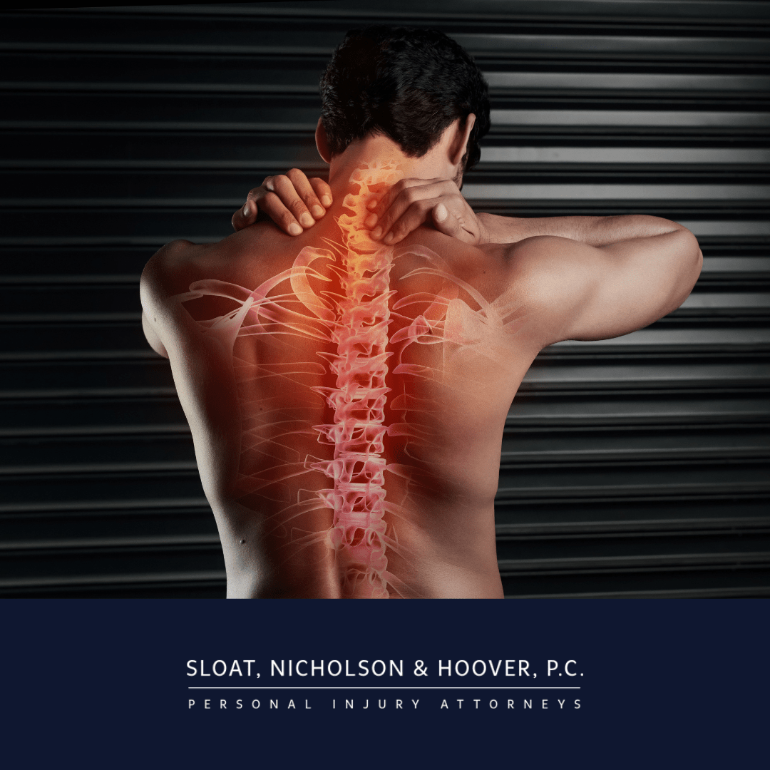 Soft Tissue Injury from a Car Accident